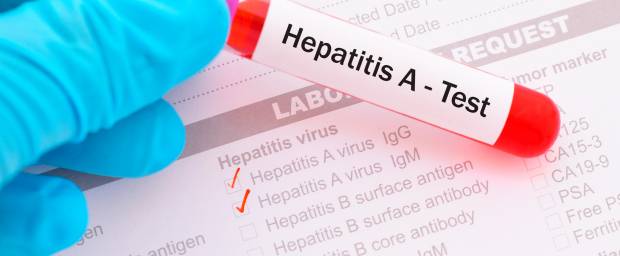 Hepatitis A Gelbsucht