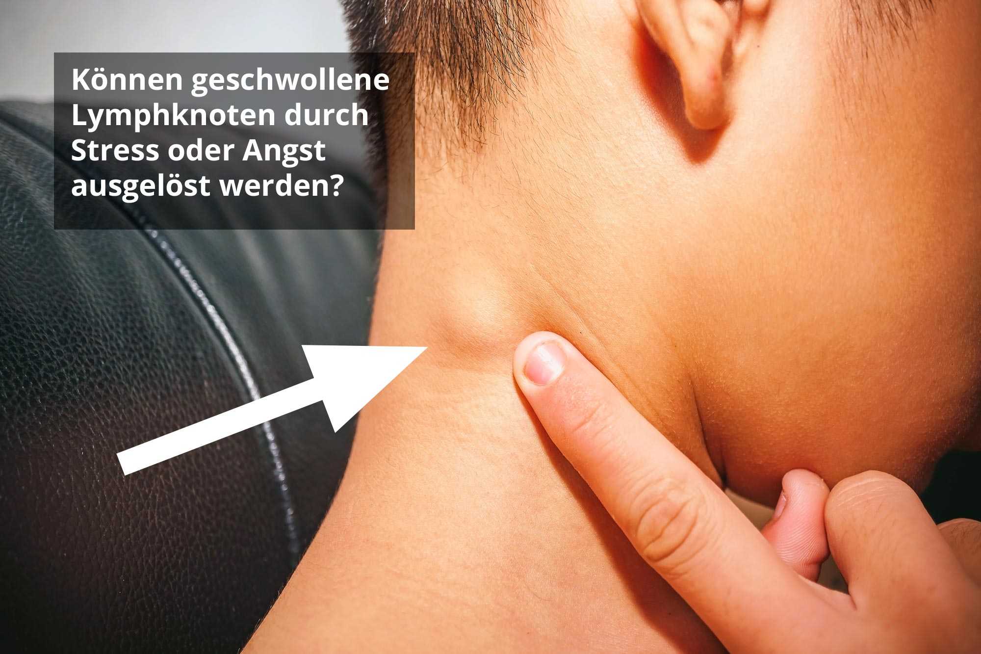 Geschwollenen lymphknoten am hals