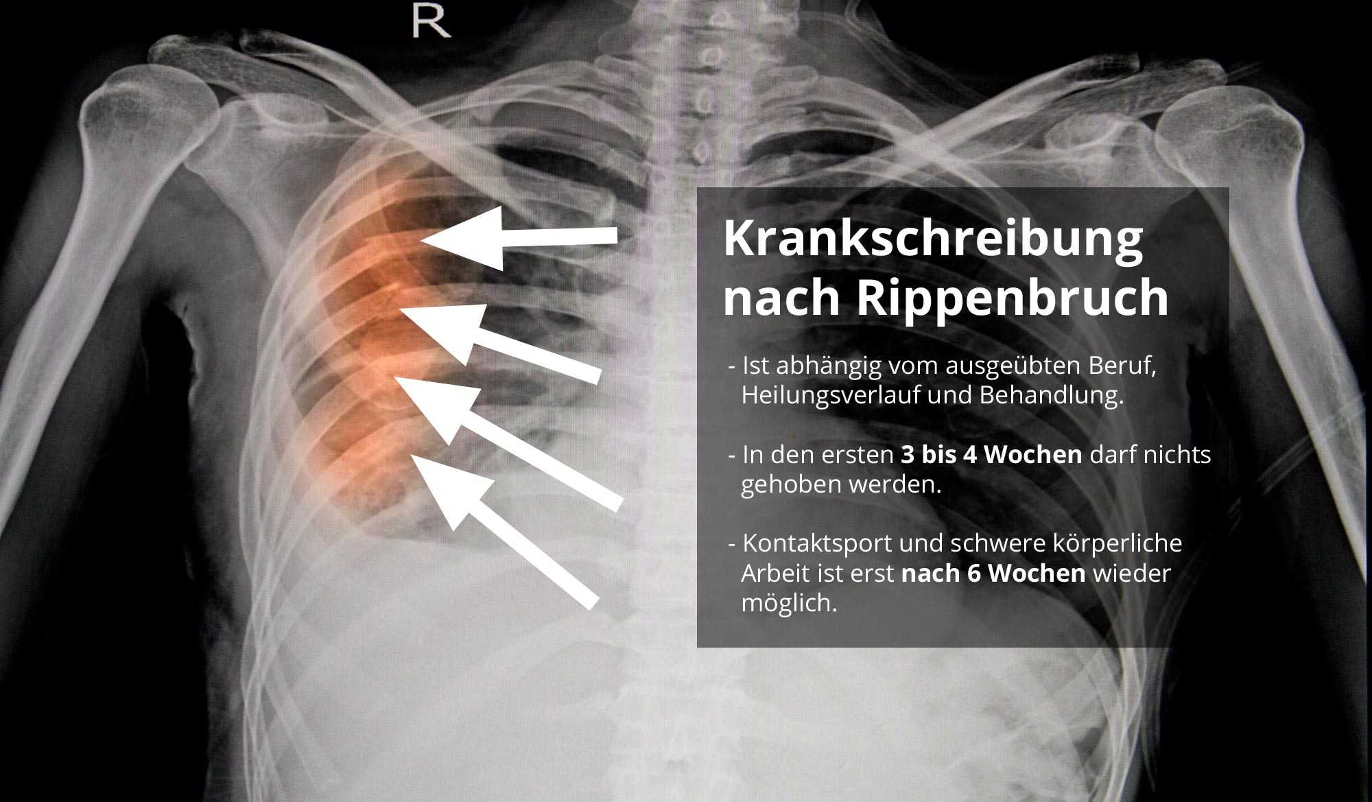 Wie lange ist man krankgeschrieben nach gallen op