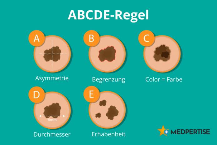 ABCDE-Regel