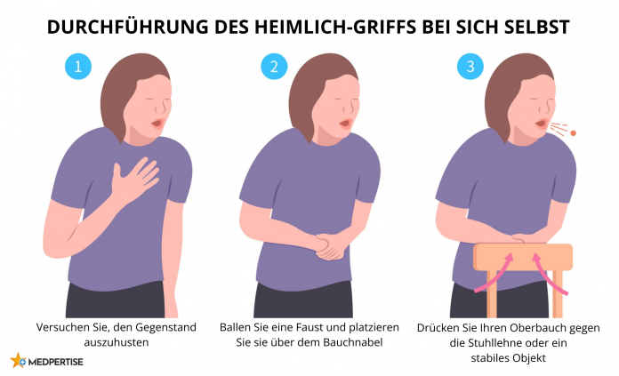 Durchführung des Heimlich-Griffs bei sich selbst